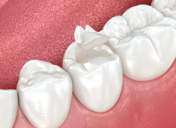 Our Range of Dental Services in Palm Beach Gardens, FL